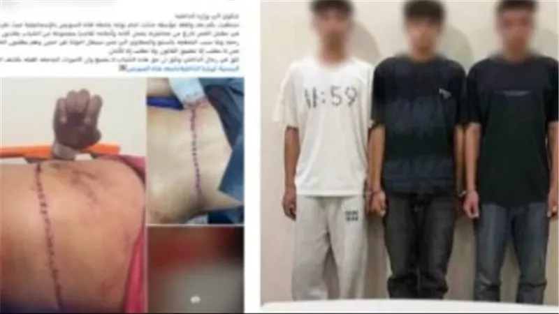 التعدى على 3 طلاب بسلاح أبيض فى الإسماعيلية 